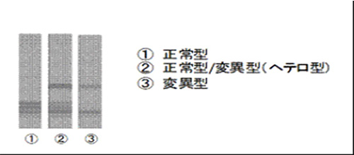 ムレ肉因子の遺伝子分析例